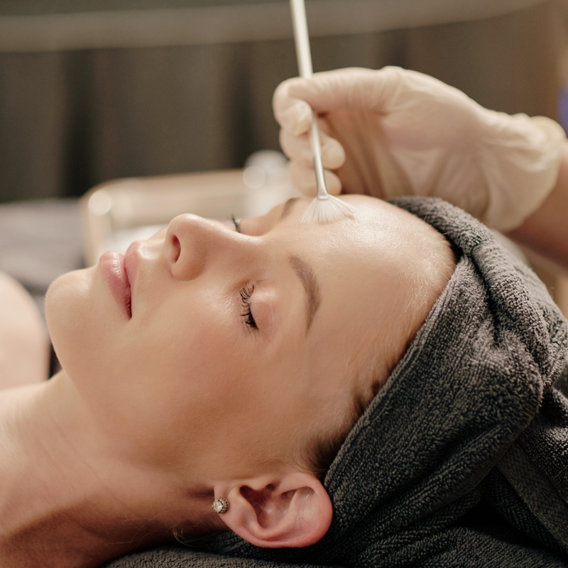 Miracle 10 Chemical Peel